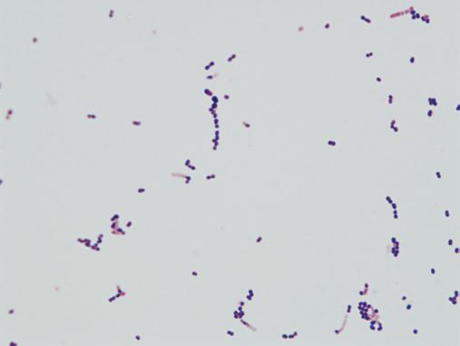 Streptococcus agalactiae Figura 1. Streptococcus agalactiae. Coloración de Gram. 1.000X. Laboratorio Clínico Hematológico. Medellín, Colombia. Figura 2. Streptococcus agalactiae, muestra de orina.