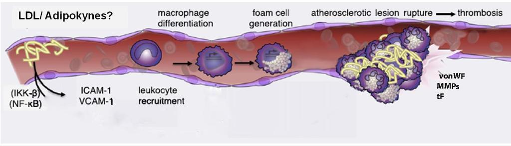 Células endoteliales de cordón umbilical de recién