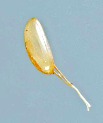 Figura 8: Espiráculos caudales de la larva. (Créditos: E. Beers, July 2010.