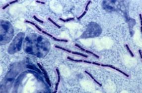 Cromosoma Plasmidios o plásmido Transposones Nucleoide Naturaleza química CAPSULA Factor