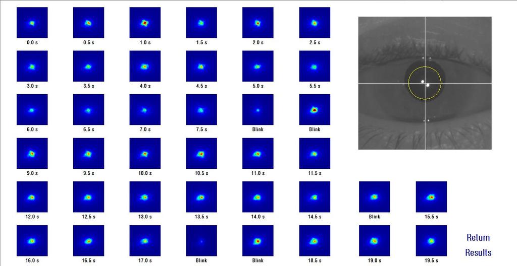 Figura 15. Medida de Tear Film Analysis Tras los 20 segundos, puede ver las 40 imágenes adquiridas. Debajo de cada una de ellas, puede ver el momento exacto en que fueron capturadas.