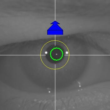 En algún momento de ese avance, un círculo verde aparecerá alrededor de la imagen de Purkinje del laser, en una zona muy céntrica de la imagen.