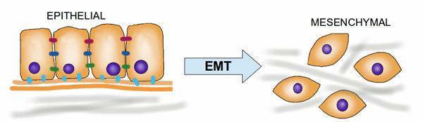 Transición epitelial-mesenquimática (TEM) Proceso fisiopatológico asociado con la remodelación tisular durante el cual células epiteliales adquieren
