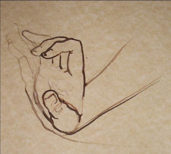 El segundo dedo, o dedo índice se eleva con respecto a los demás, por lo que la articulación de la primera falange con el metacarpiano se encuentra en extensión, y el resto de articulaciones