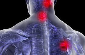 Dolor de cuello y espalda cuando todo NO es de Traumatología Dr