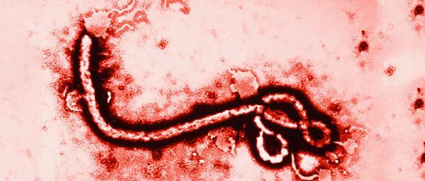 2.2. LA ENFERMEDAD POR VIRUS DEL ÉBOLA 2.2.1 ETIOLOGIA La enfermedad por el virus del Ébola (EVE), antes llamada fiebre hemorrágica del Ébola, es una enfermedad infecciosa vírica incluida en el grupo