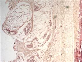 Imagen de campo del preparado de piel, las flechas indican el tejido adiposo en la hipodermis. Imagen de alto aumento (200x) del tejido adiposo.