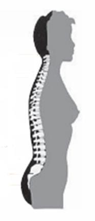 Está compuesta por 33 vértebras unidas por los discos intervertebrales y ligamentos.