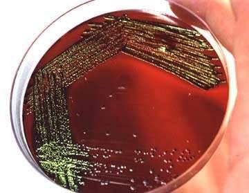 agar EMB (Escherichia coli) Agar sangre con estría