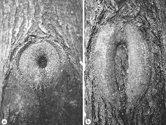Fig. 1. a: Tilia spp., corte en el collar de la rama, formación del callo nueve años después de la poda. b. Tilia spp., corte a ras, formación del callo nueve años después de la poda; la herida está menos cerrada que la del collar.