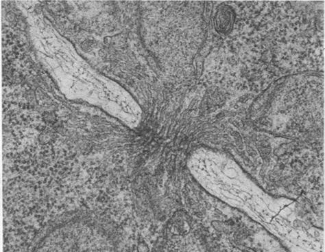 Citocinesis incompleta poro septal o sinapsis intercelular