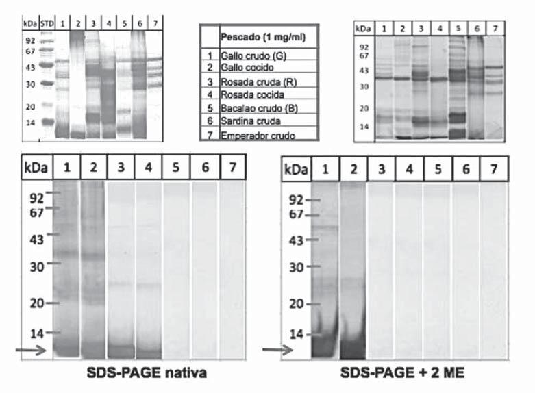 46 SESIONES INTERHOSPITALARIAS 2014-2015 Fig. 1. SDS-Page Immunoblotting IgE. c) SDS-PAGE Immunoblotting- IgE (fig. 1) Los extractos de pescados se separaron por masa molecular mediante SDS-PAGE.