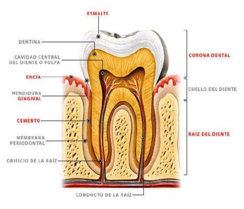 bacteriana cuando la higiene dental no es la adecuada, ocasionando las llamadas enfermedades periodontales (gingivitis y periodontitis).