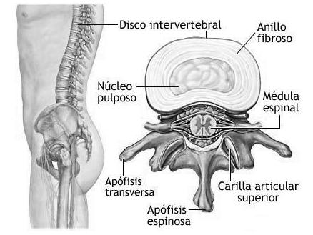 Discos Intervertebrales Entre cada uno de los cuerpos vertebrales se encuentra una especie de "cojín" denominado disco intervertebral.