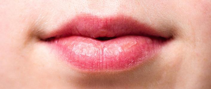 Las grietas en los labios son molestas y además poco estéticas. Y si utilizas un producto con químicos añadidos para solucionarlo, es posible que sin querer lo acabes ingiriendo.