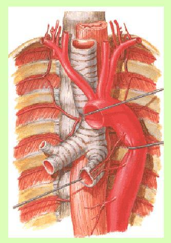 Circulación bronquial La circulación bronquial, que nace de la aorta e irriga la pared de la vía aérea y el parénquima pulmonar.
