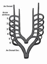 - Un segundo tipo esta asociado a un segmento largo de estenosis traqueal causado por presencia de anillos cartilaginosos completos, sin componente membranoso ("Tráquea rígida en O").