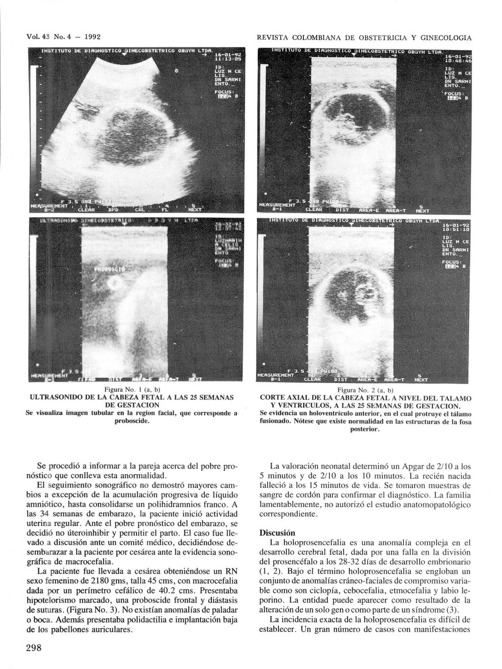 Vol. 43 No. 4-1992 REVISTA COLOMBIANA DE OBSTETRICIA Y GINECOLOGIA Figura No.