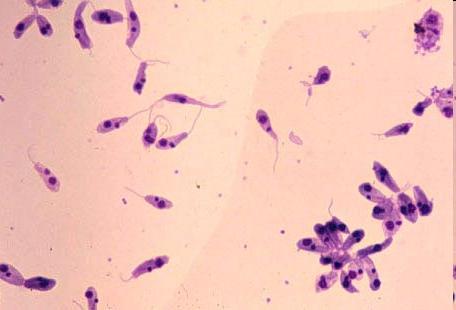 Leishmaniosis -Infección del tejido reticulo-endotelial (monocito/macrófago) de vertebrados -Transmitida por vector artrópodo Phlebotomos -2 Estadíos : Proamastigote y amastigote (interior