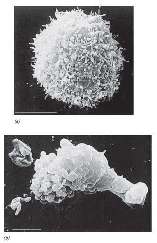 Figura 15.37 Comparación de una célula normal y células apoptóticas.