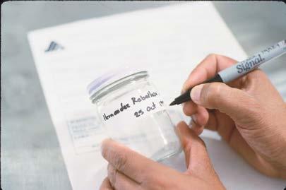 Etiquetado del recipiente de la muestra Etiquete con nombre del paciente, número de identificación y fecha de toma de