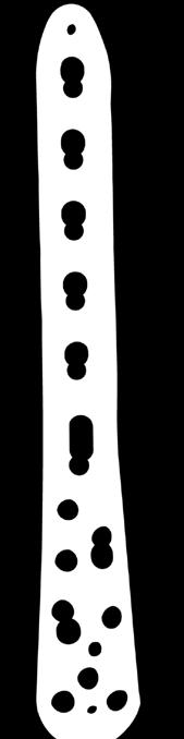 0 mm Tres tornillos de bloqueo distales divergen a través del hueso subcondral y son paralelos a la articulación Seis agujeros