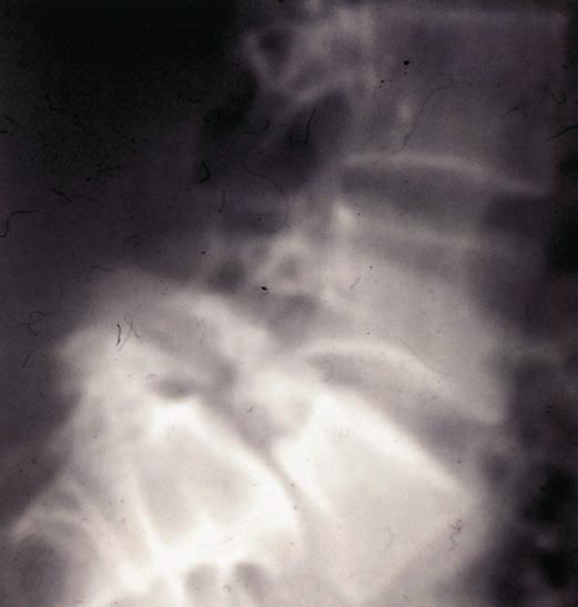 En la imagen, A: es el cuello (ístmo), B: la oreja (articular superior), C: la pata anterior (articular ), D: el morro (apófisis transversa), E: la pata posterior (espinosa).