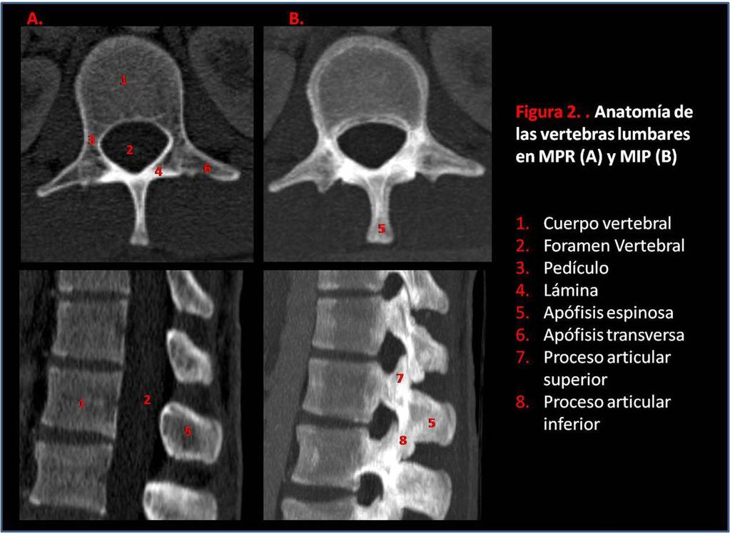 Fig. 2: Anatomía de las vertebras