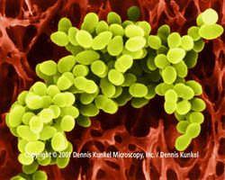 MICROBIOLOGÍA DEL SARM Familia Micrococcaceae Género Staphylococcus Cocos grampositivos dispuestos en racimos, inmóviles,