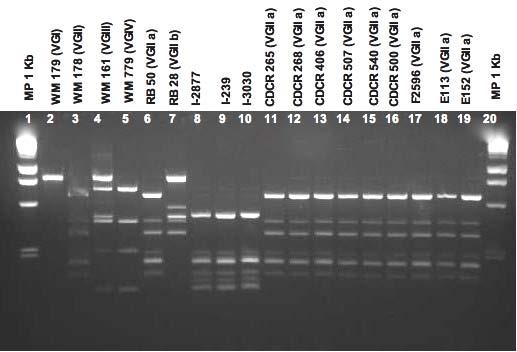 Figura 11. RFLP del gen URA5 de aislamientos colombianos y aislamientos procedentes de Vancouver, empleando las enzimas de restricción Hha I, Dde I y BsrG I.
