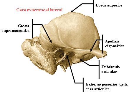 1) PORCIÓN ESCAMOSA Tiene una porción vertical y otra horizontal. La vertical tiene una cara externa (exocraneal) y una interna (endocraneal). 1.