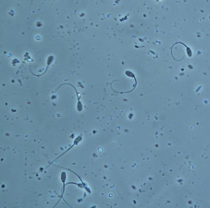 A B C Figura 5. Análisis del estado morfológico de los espermatozoides. En verde se observan los que presentan una morfología anormal; en púrpura los considerados como normales.