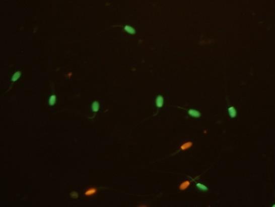 A B Figura 7. Imagen tomada a 400x. Con el filtro B-2A se observan las células viables (A) y con el filtro G-2A se observan las células no-viables (B).