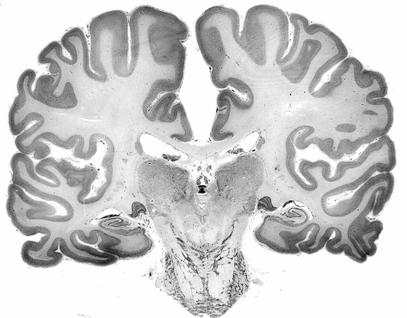 Generalidades: sistema nervioso central La sustancia gris puede aparecer como: En el encéfalo: Sust. gris periventricular apuesta al epit. ependimario Núcleos masas de sust. gris entre la sust.