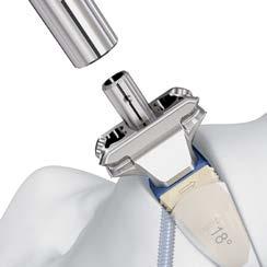 Instrumento único para la inserción del implante Reduce el número de cambios de instrumental Soporte desmontable El