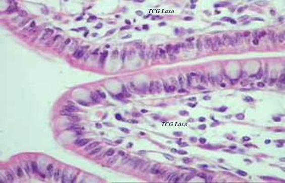 ocupa casi toda la célula, alrededor de este se encuentra un delgado halo de citoplasma basófilo.