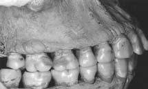 La vista oclusal superior muestra dentición completa, buena forma de arco y ligera rotación de
