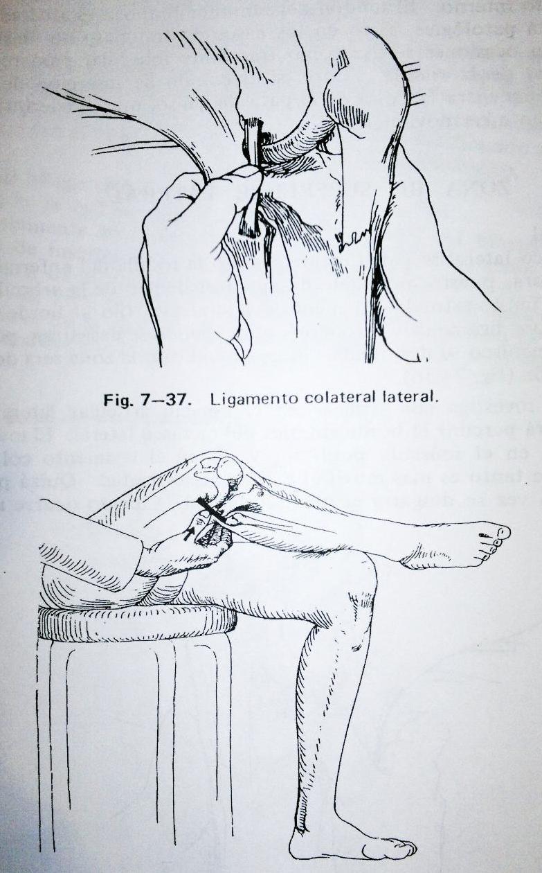 Superficie lateral Ligamento colateral lateral