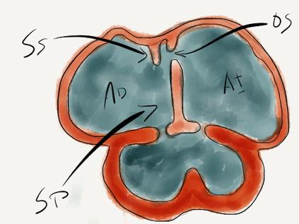 Una vez incorporada la aurícula va comenzando su septación o tabicación interna para formar las dos aurículas (figura 4).
