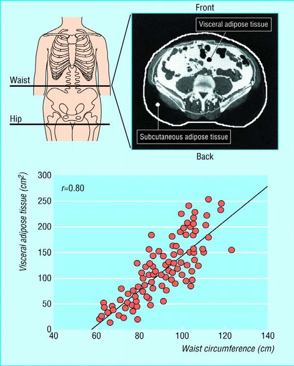 Perímetro de cintura como un marcador cierto de grasa visceral La cuantía de grasa visceral por TC abdominal tiene una excelente correlación