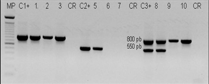34 Determinantes genéticos asociados con la resistencia a cefalosporinas, aminoglicósidos y quinolonas en aislamientos hospitalarios de Acinetobacter baumannii 9 Y 10) positivas para el gen bla TEM;