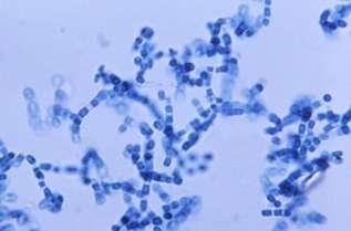 Diagnóstico Microbiológico (3) Microscópicamente: Hifas delgadas y septadas con artrosporas rectangulares de 2 x 4 ó 3 x 6 µm También hay artroconidias de pared gruesa, alternos a lo largo de la hifa