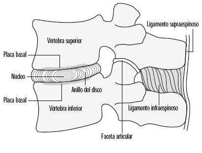 Articulación entre dos cuerpos vertebrales: Anfiartrosis Parte central: Núcleo Pulposo Deriva de la notocorda 88%