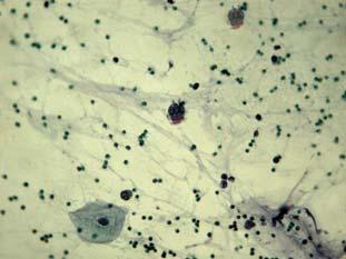 2. Células Cilíndricas ciliadas: Cilíndricas con una placa terminal cubierta por cilios. Son habituales ya que son las que forman el epitelio respiratorio. 3.