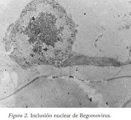 Efecto citopático: Cuerpos de inclusión Se pueden ver en cultivos celulares in