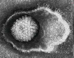 Envoltura: La envoltura consiste en material proveniente de la membrana celular externa de la célula infectada, que el virus obtiene al salir de ésta.