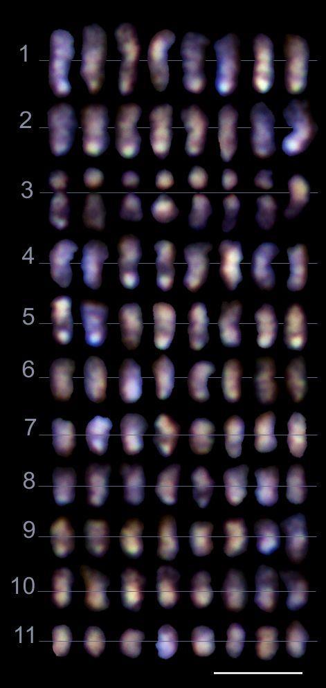 detalle, se observa un sexto representante del cromosoma 3 con condensación