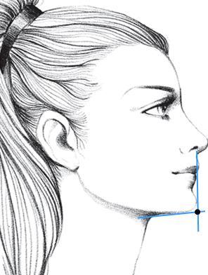 Mentón: Posición, volumen, tonicidad. Para identificar la proyección del mentón en relación al cuello se mide el ángulo formado por la intersección de los planos Sn-Gn Gn -C.