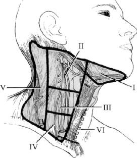 Triángulo cervical anterior. Limitado por el borde anterior de ambos músculos esternocleidomastoideos, la rama horizontal de la mandíbula y la porción superior de la clavícula.