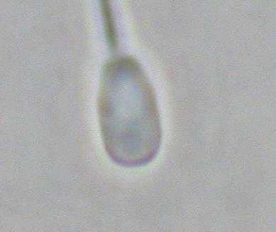 Número mínimo de espermatozoides a analizar: 00 > 200.